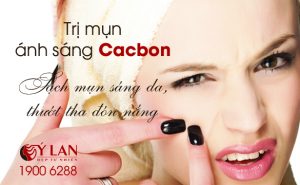 tri-mun-anh-sang-cacbon-195-x-120