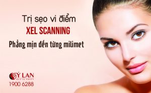 tri-seo-vi-diem-195-x-120