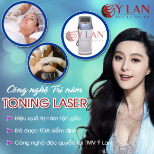 CN trị nám hàng đầu Toning Laser