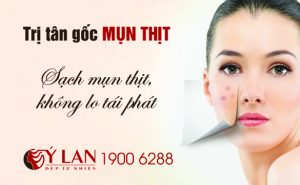 dieu-tri-mun-thit-195-x-120