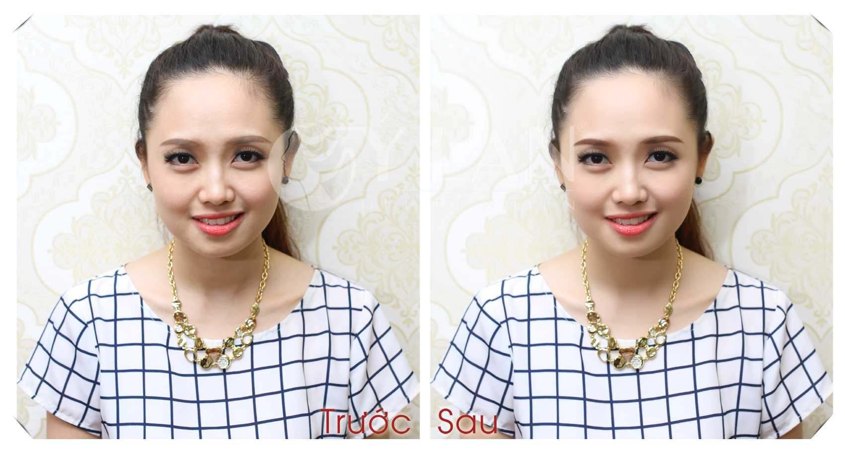 kết quả Phun thêu lông mày tán bột 1