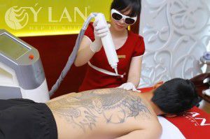 Xăm phun xóa được không