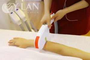 Tẩy lông vĩnh viễn vùng nách