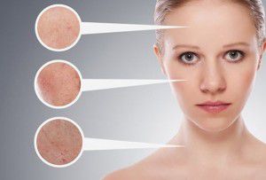 Điều trị mụn ở đâu hiệu quả