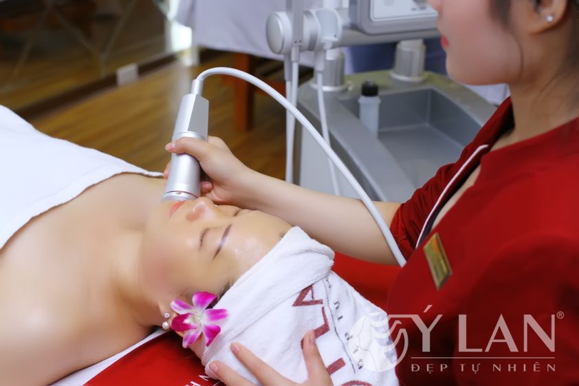 Trị nám da ở mặt