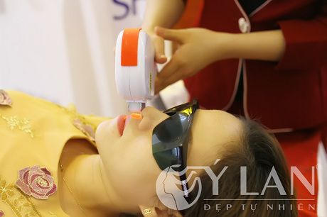 Tẩy sạch lông mặt
