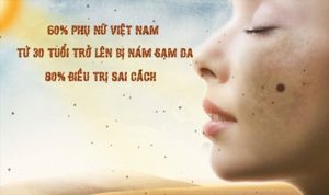 benh-nam-da-la-gi-va-dieu-tri-bang-cach-nao-1