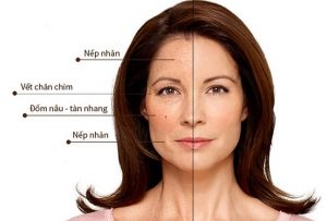 giup-ban-cham-soc-da-o-do-tuoi-40-50-hieu-qua-hon