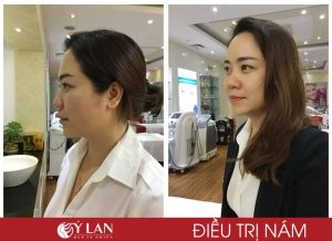 tri-nam-tan-nhang-1