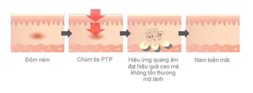 ptpa