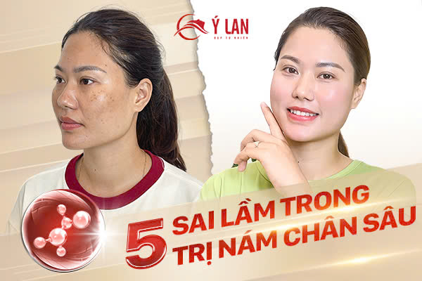 Dieu_tri_nam_chan_sau:_5_sai_lam_thuong_gap