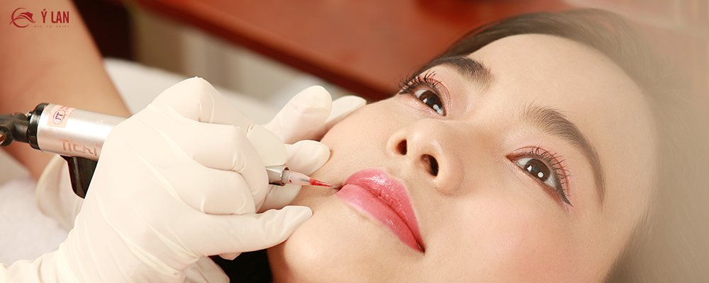 Phun_moi_phu_bong_Collagen