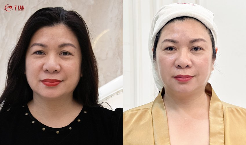 Review_khach_hang_sau_10_ngay_thuc_hien_tre_hoa_nang_co_Ultra_Focus