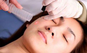chữa tàn nhang hết bao nhiêu tiền