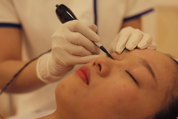 xóa xăm mí mắt