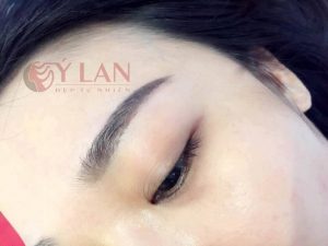 phun-long-may-khac-phuc-tinh-trang-long-may-ngan