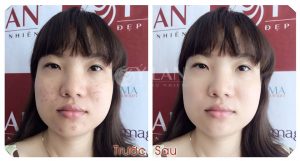 tri-mun