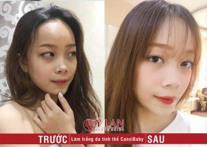 lam-trang-da-tinh-the-canxi-baby-skin-2