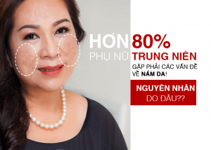 tri-nam-lau-nam