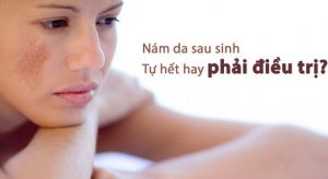 tri-nam-sau-khi-sinh