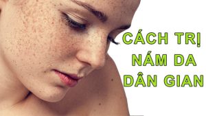 cach-tri-nam-bang-meo-dan-gian-1