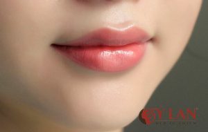 phun-moi-phu-bong-collagen-1