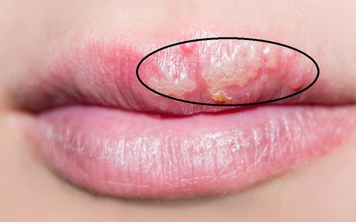 3 dấu hiệu phun môi bị hỏng rõ rệt nhất Cách khắc phục